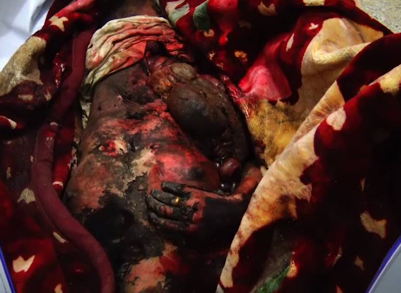 12404694_572149316283329_1936064432_n