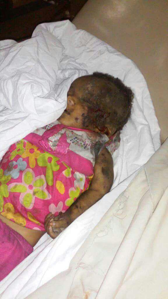 صور من المجزرة التي ارتكبها طيران العدوان السعودي الأمريكي في حي الشهداء واستشهد فيها اسرة كاملة