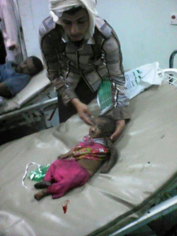 صور من المجزرة التي ارتكبها طيران العدوان السعودي الأمريكي في حي الشهداء واستشهد فيها اسرة كاملة