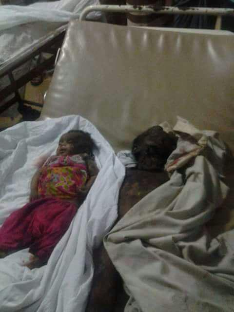 صور من المجزرة التي ارتكبها طيران العدوان السعودي الأمريكي في حي الشهداء واستشهد فيها اسرة كاملة