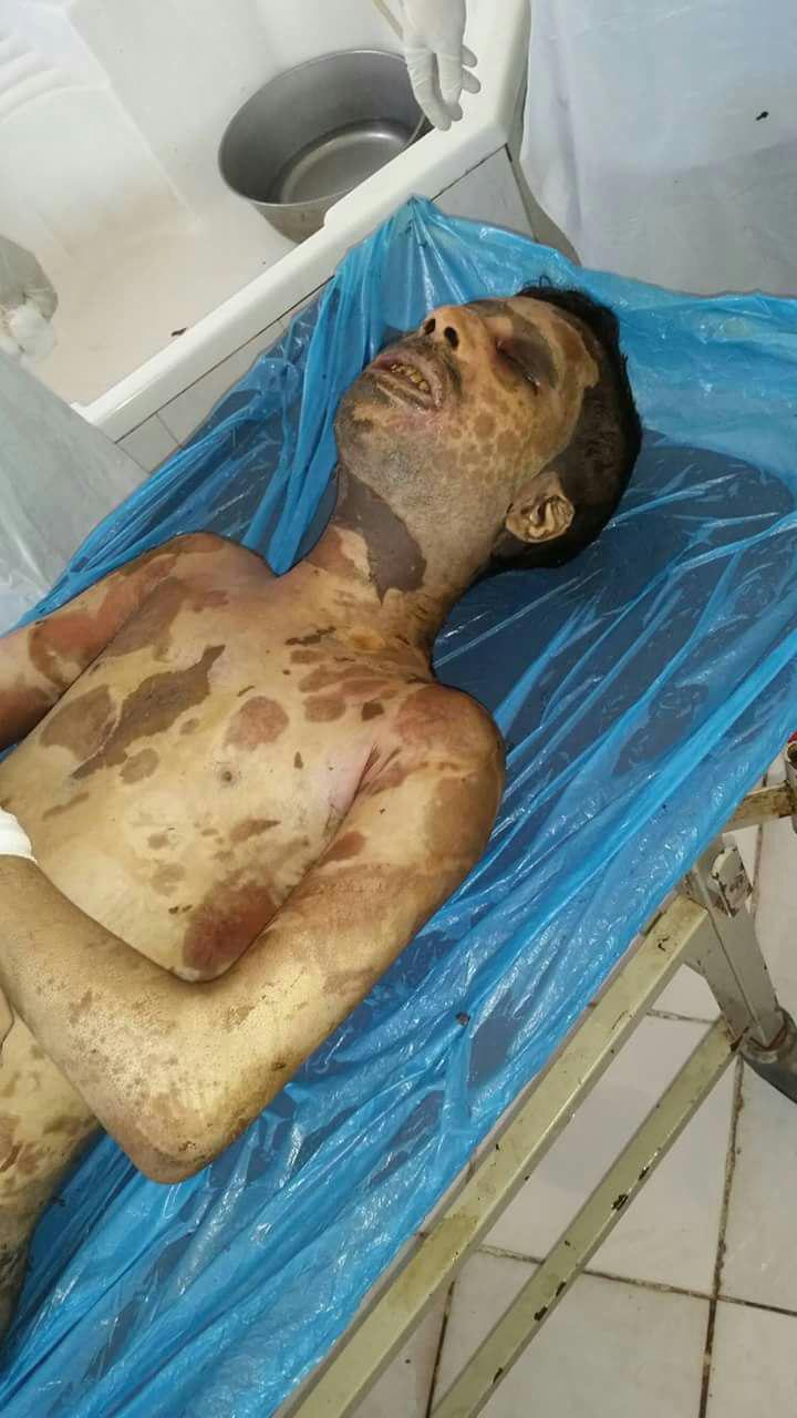  شهداء وجرحى وجثث متفحمة جراء غارة لطيران العدوان بالحديدة