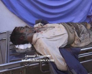 الحمزات - صعدة نيوز