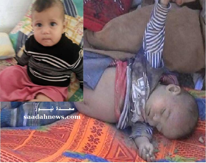 الطفل : كيان عمار فارس الذي استشهد اضافة الى استشهاد والدته وجدته وأخويه ساجد وعبدالملك وامرأتين أخريات .