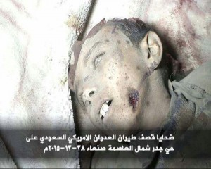 شهداء وجرحى في غارات مكثفة لطيران العدوان على العاصمة صنعاء (صور)