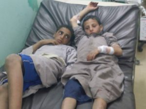 صعدة : إصابة 3 اطفال بقنابل عنقودية ألقاها العدوان على منطقة العلابي بمديرية صعدة (صورة)