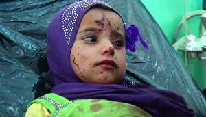 إصابة طفلة بجروح جراء غارة لطيران العدوان على مديرية مجز بمحافظة صعدة