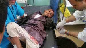 صور | إصابة طفلين بجروح جراء انفجار قنبلة من مخلفات العدوان بمحافظة صعدة
