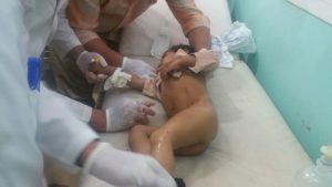 إصابة ثلاثة أطفال بجروح جراء انفجار قنبلة عنقودية للعدوان بمحافظة صعدة ( اسماء + صور )