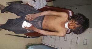 إصابة طفل بجروح إثر انفجار قنبلة عنقودية في مديرية الصفراء بصعدة ( صور )