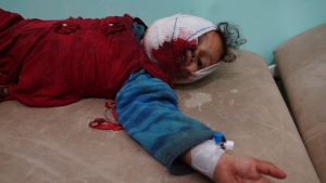 إصابة طفلة جراء قصف سعودي على مديرية رازح بصعدة (صور)