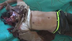 بالصور | إستشهاد 8 مواطنين في جريمتين جديدتين للعدوان بمحافظة صعدة