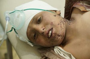 بالأسماء + صور | إصابة 3 مواطنين  بينهم أطفال بغارة لطيران العدوان على مديرية باقم بصعدة