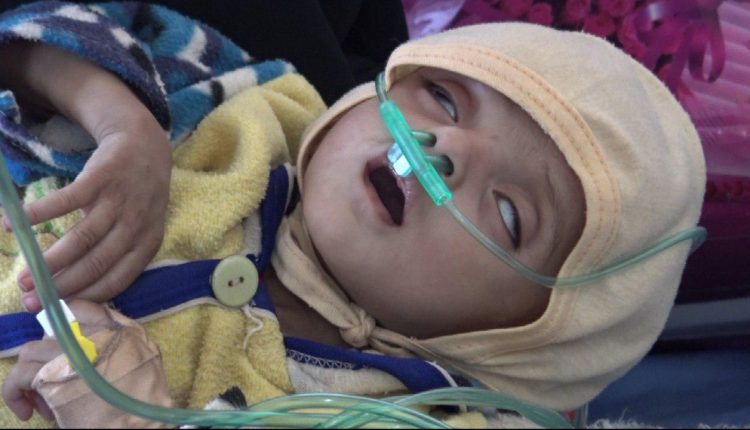 أطفال-صعدة11