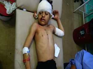 اسماء + صور | إصابة طفلين بقصف صاروخي ومدفعي سعودي على صعدة