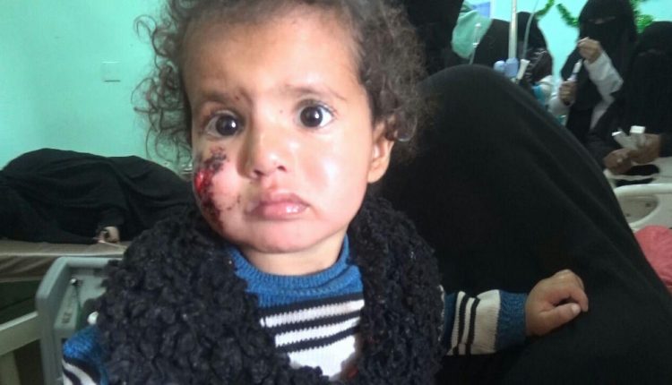 photo_٢٠١٨-١١-٢٩_١٥-٣٤-٠٤