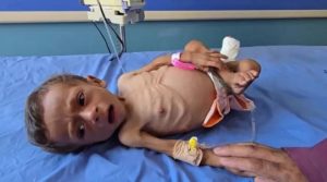 10 شهداء بينهم طفلان بسبب المجاعة في غزة خلال 24 ساعة