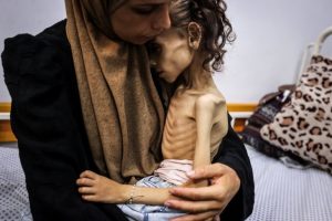 “الصحة بغزة”: 5 وفيات بينهم طفلان نتيجة المجاعة وسوء التغذية خلال الـ24 ساعة الماضية