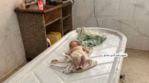 الصحة بغزة: ثلاث حالات وفاة جديدة نتيجة المجاعة وسوء التغذية